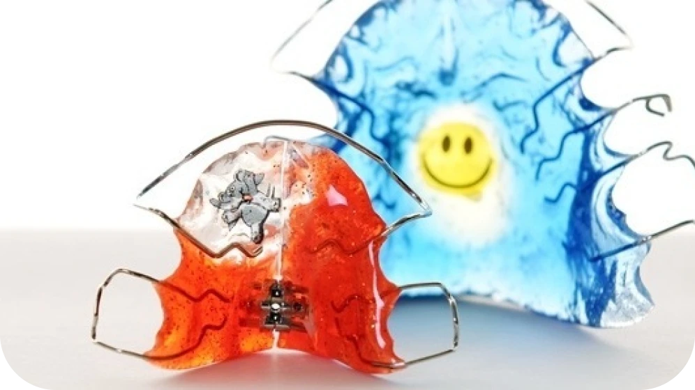 plaque palatine correction grenoble machoire Plaque palatine Cabinet d’orthodontie Drs. ROCCA & Associés