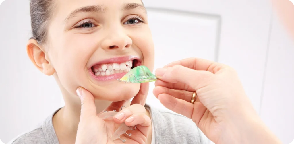 plaque palatine orthodontie grenoble enfant x Plaque palatine Cabinet d’orthodontie Drs. ROCCA & Associés